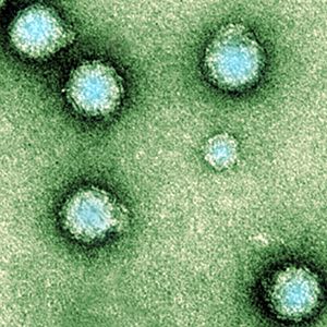 A Brief History Of The 5 Worst Computer Viruses Of All Time