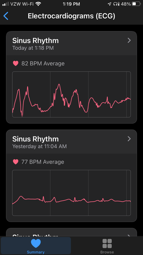 How to Take an ECG on the Apple Watch