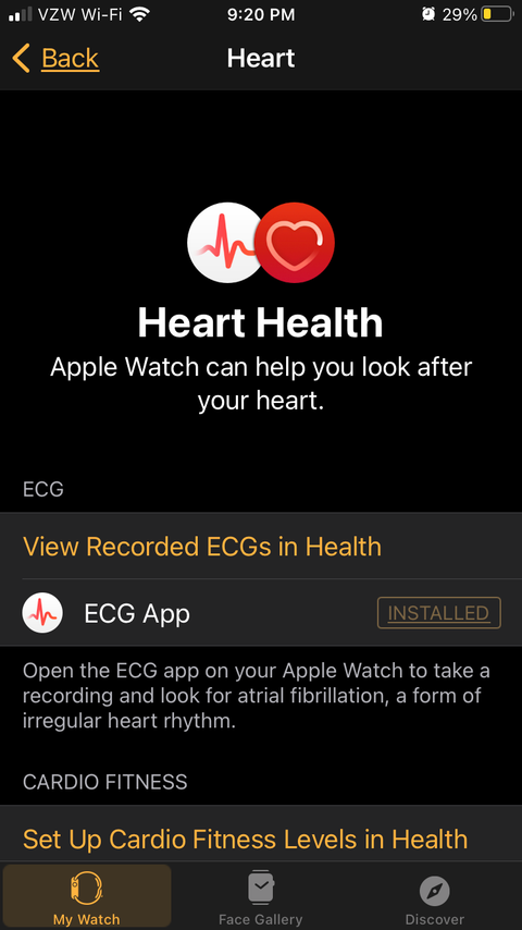 How to Take an ECG on the Apple Watch