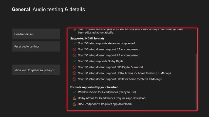How to Ensure Audio Plays Only Through Your Headset on Xbox Series X|S