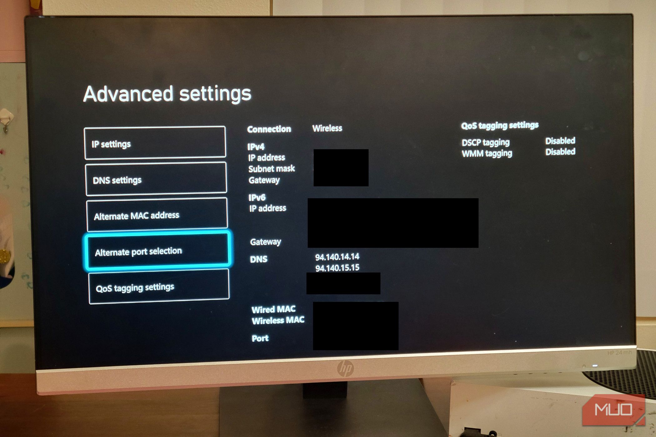 A microsoft Xbox showing the DNS IP