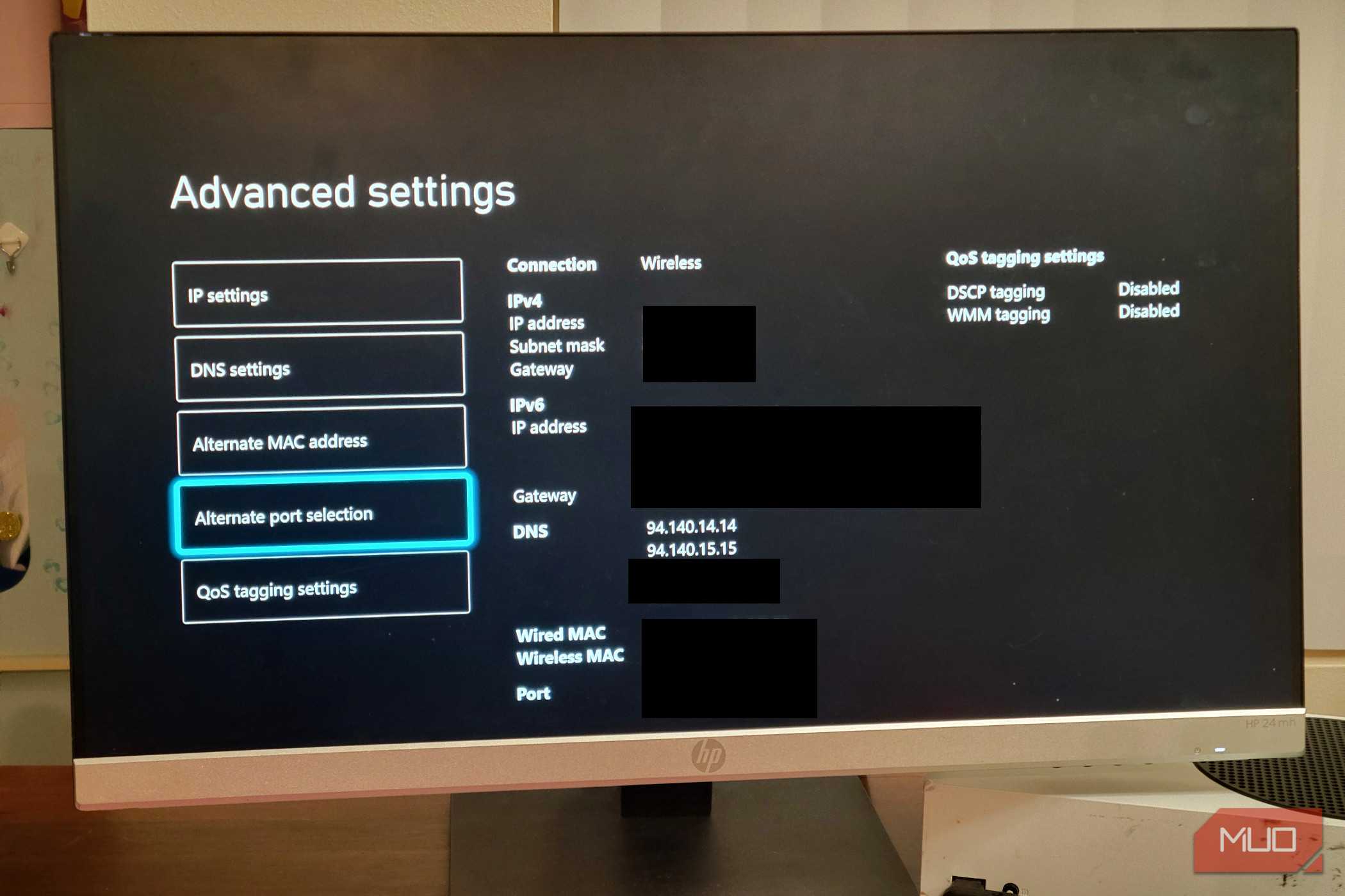 A microsoft Xbox showing the DNS IP