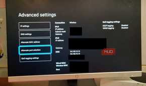 A microsoft Xbox showing the DNS IP