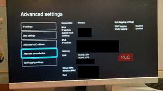 A microsoft Xbox showing the DNS IP