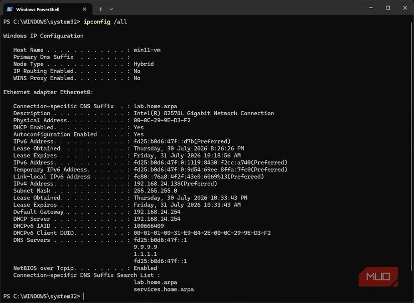 Windows 11 VM ipconfig /all showing custom DHCP option results