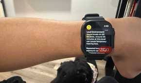 Apple Watch Ultra 3 Hearing Loss Alert
